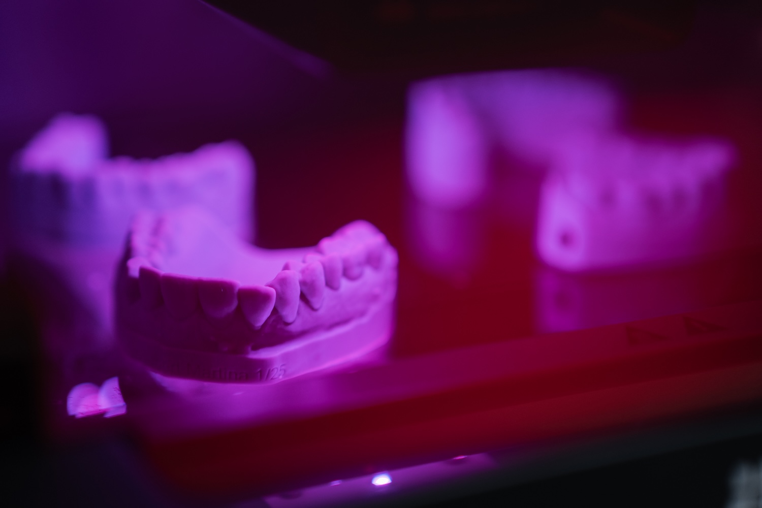 Nahaufnahme von einem Gebissmodell für hochwertigen Zahnersatz